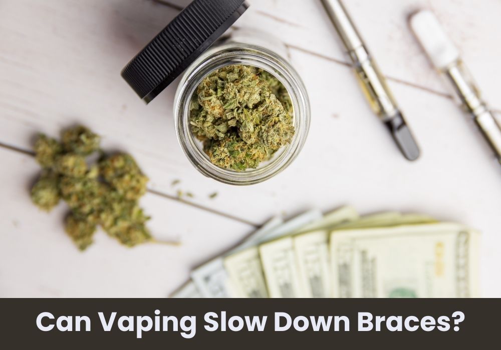 Can Vaping Slow Down Braces?